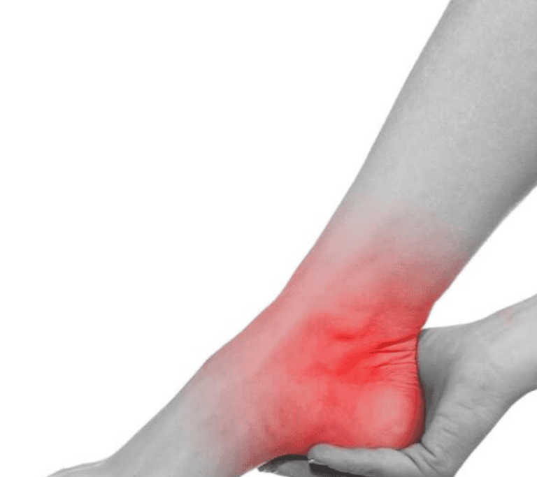 Enkelklachten - Sport Accent