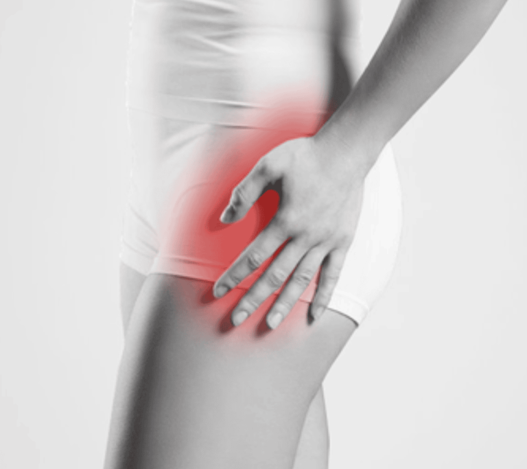 Heupklachten - Sport Accent